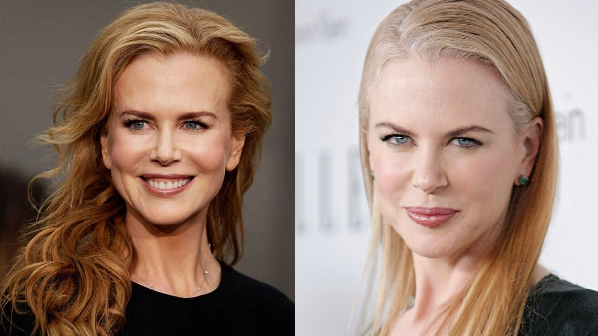 Who is Nicole Kidman Married to